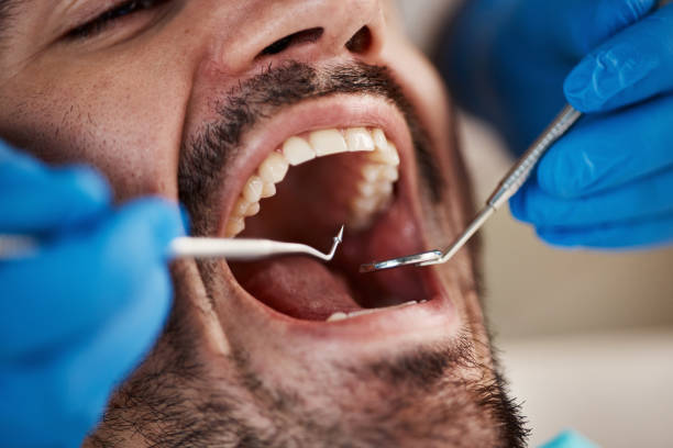 Best Emergency Dentist for Knocked-Out Tooth in St Croix Falls, WI